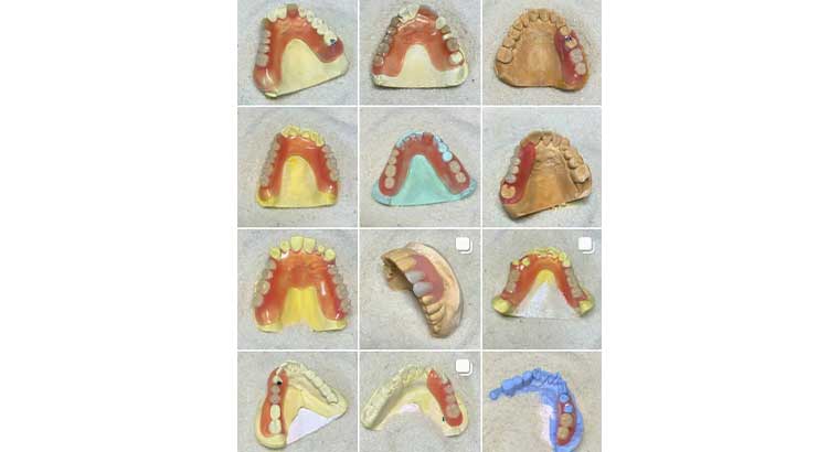 دندانسازی تخصصی در فردیس