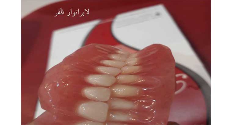 ساخت دندان مصنوعی ژله ای در شمال تهران