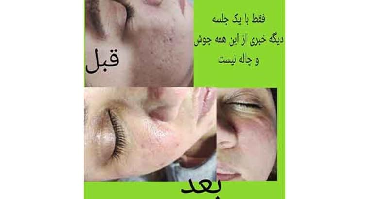 آموزش درمان پوست در تهرانپارس