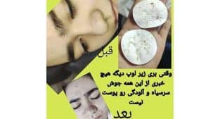آموزش درمان پوست در تهرانپارس